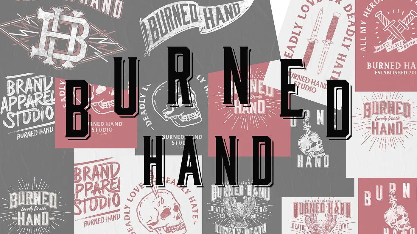 Burned Hand